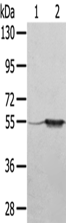 Anti-TRIM35 Rabbit Polyclonal Antibody