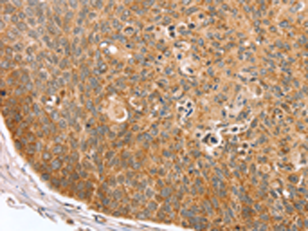Anti-TRIM62 Rabbit Polyclonal Antibody