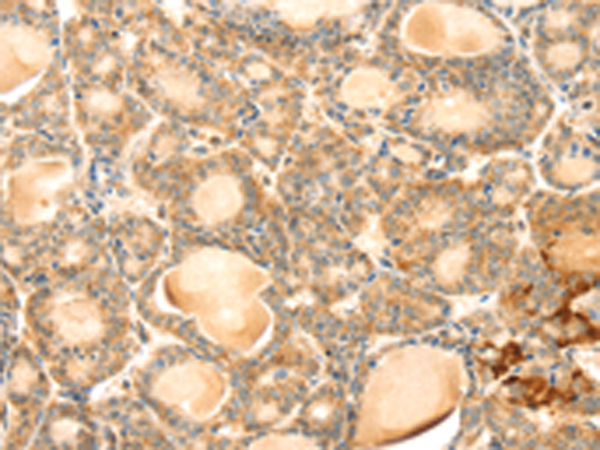Anti-EVA1A Rabbit Polyclonal Antibody