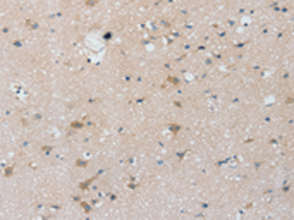 Anti-Pentraxin 3 Rabbit Polyclonal Antibody