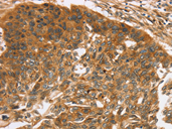 Anti-TNFSF15 Rabbit Polyclonal Antibody