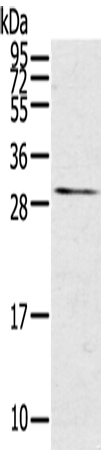 Anti-TNFSF15 Rabbit Polyclonal Antibody