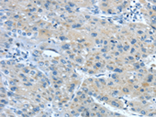Anti-TNIP1 Rabbit Polyclonal Antibody