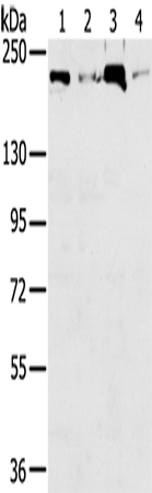 Anti-Topoisomerase II beta Rabbit Polyclonal Antibody