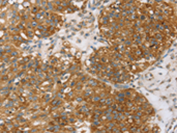 Anti-Tumor Protein D54 Rabbit Polyclonal Antibody