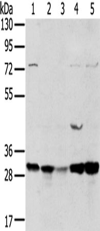 Anti-Tumor Protein D54 Rabbit Polyclonal Antibody