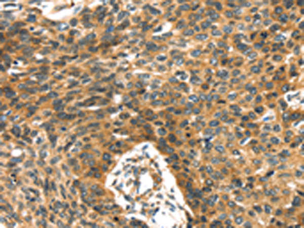 Anti-PRSS50 Rabbit Polyclonal Antibody