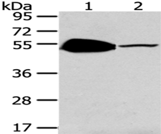 Anti-TSPY Like Protein 1 Rabbit Polyclonal Antibody