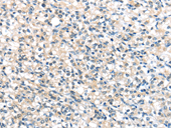 Anti-UCP 3 Rabbit Polyclonal Antibody