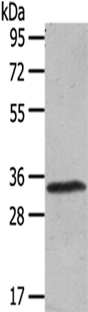 Anti-UCP 3 Rabbit Polyclonal Antibody