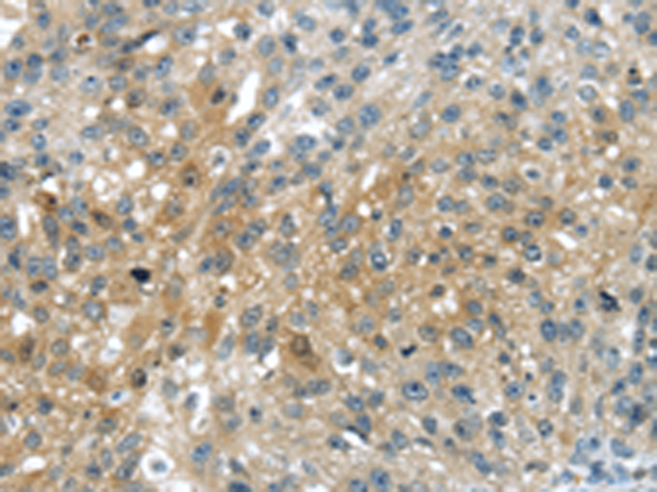 Anti-Uridine Phosphorylase 2 Rabbit Polyclonal Antibody