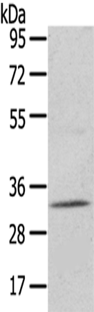 Anti-Uridine Phosphorylase 2 Rabbit Polyclonal Antibody