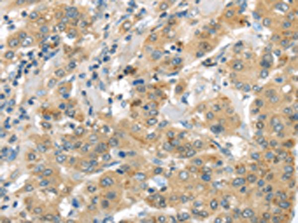 Anti-Urotensin 2B Rabbit Polyclonal Antibody