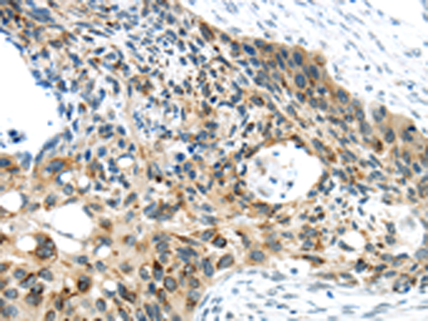 Anti-VAMP2 Rabbit Polyclonal Antibody