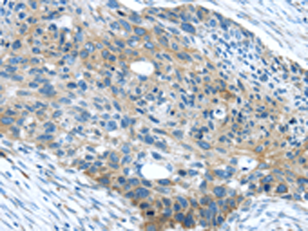 Anti-WAVE 2 Rabbit Polyclonal Antibody