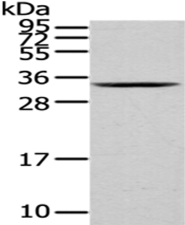 Anti-hnRNP C1/C2 Rabbit Polyclonal Antibody