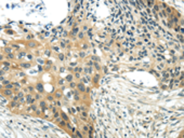 Anti-CHGA  Rabbit Polyclonal Antibody