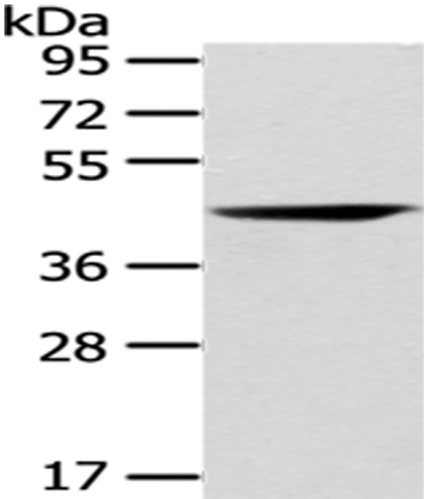 Anti-CHGA  Rabbit Polyclonal Antibody