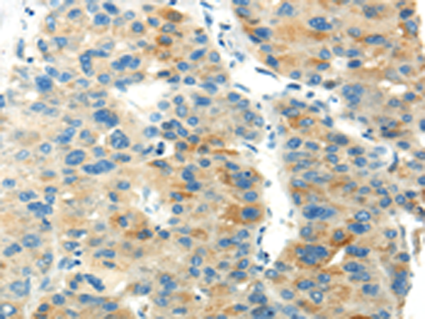 Anti-Podoplanin Rabbit Polyclonal Antibody