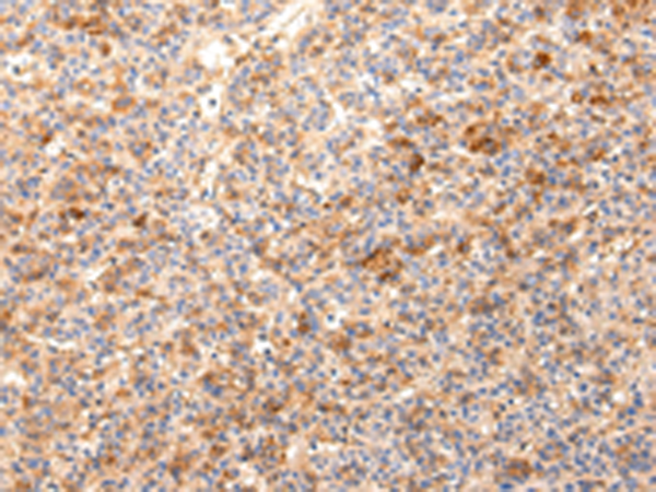 Anti-ZNF365 Rabbit Polyclonal Antibody