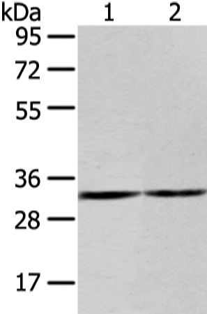 Anti-ZNF146 Rabbit Polyclonal Antibody