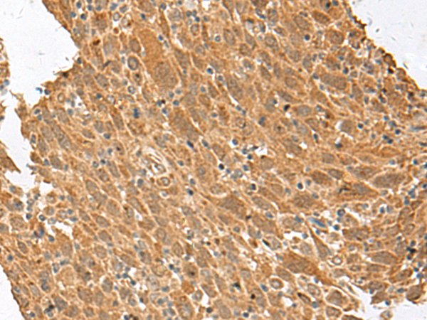Anti-HNF 1 alpha Rabbit Polyclonal Antibody