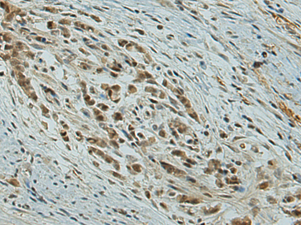 Anti-CBX7 Rabbit Polyclonal Antibody