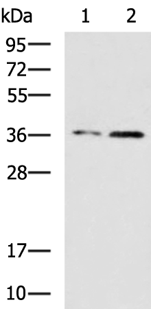 Anti-CBX7 Rabbit Polyclonal Antibody