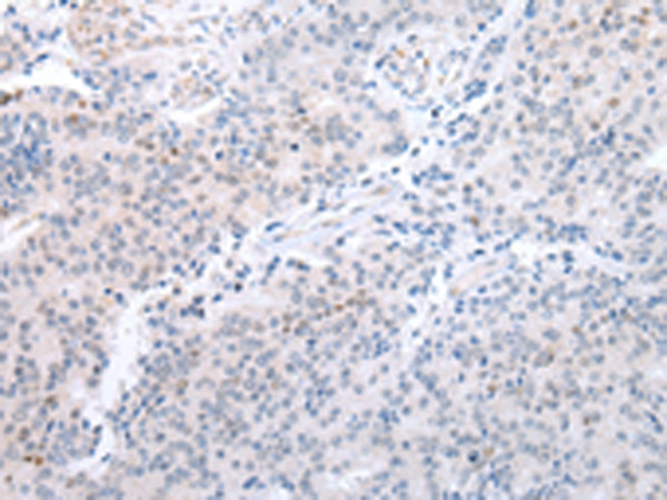 Anti-Claudin 25 Rabbit Polyclonal Antibody
