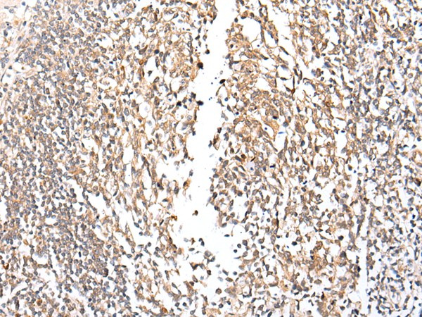 Anti-FOXP4 Rabbit Polyclonal Antibody