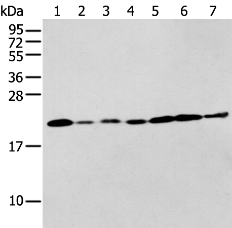 Anti-KLRC2 Rabbit Polyclonal Antibody