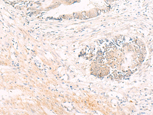 Anti-ADCYAP1 Rabbit Polyclonal Antibody