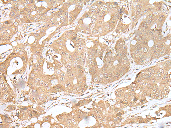 Anti-SMARCA1 Rabbit Polyclonal Antibody