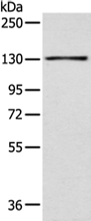 Anti-SMARCA1 Rabbit Polyclonal Antibody