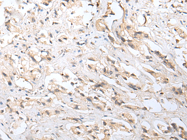 Anti-NUDT5 Rabbit Polyclonal Antibody