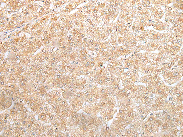 Anti-NUDT19 Rabbit Polyclonal Antibody