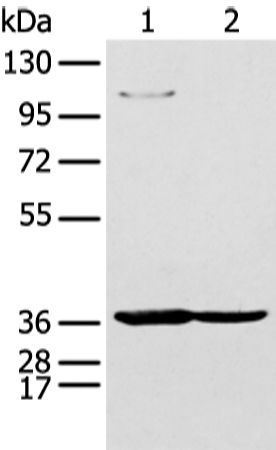 Anti-NUDT19 Rabbit Polyclonal Antibody