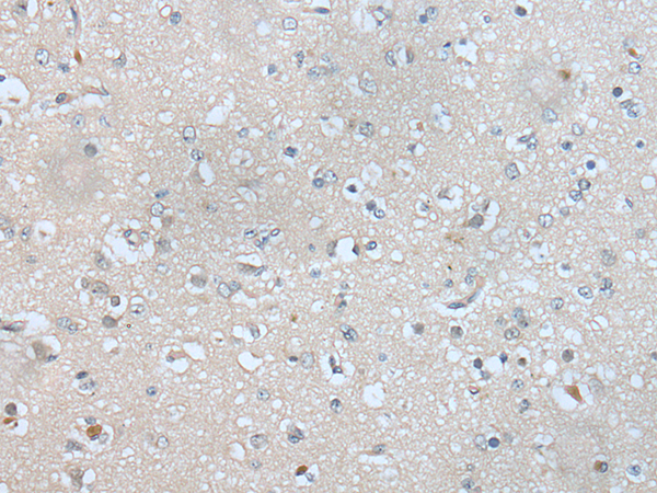 Anti-AK3L1 Rabbit Polyclonal Antibody