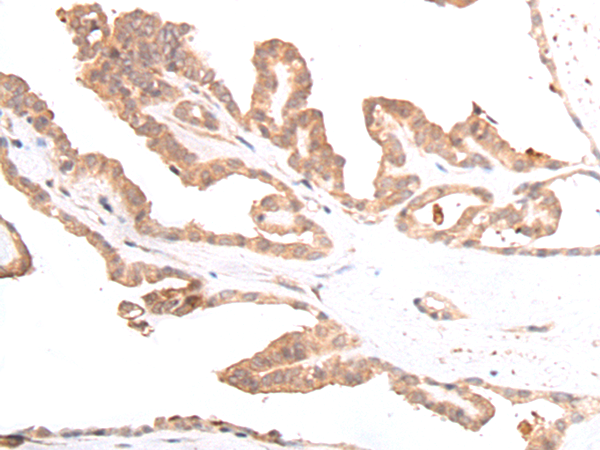Anti-GLI3 Rabbit Polyclonal Antibody