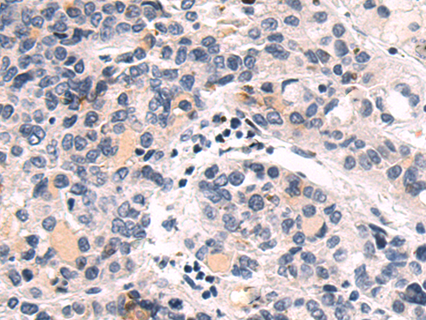 Anti-GLI1 Rabbit Polyclonal Antibody