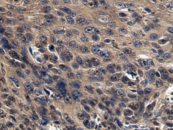 Anti-GZMH Rabbit Polyclonal Antibody