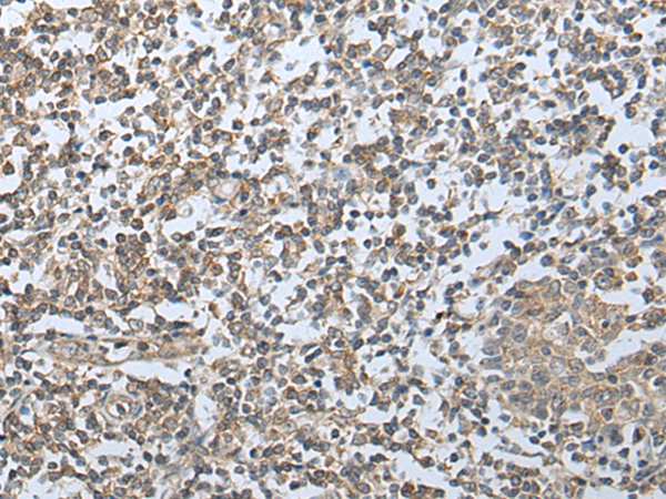 Anti-HPSE2 Rabbit Polyclonal Antibody