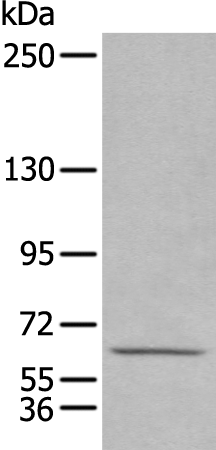 Anti-HPSE2 Rabbit Polyclonal Antibody