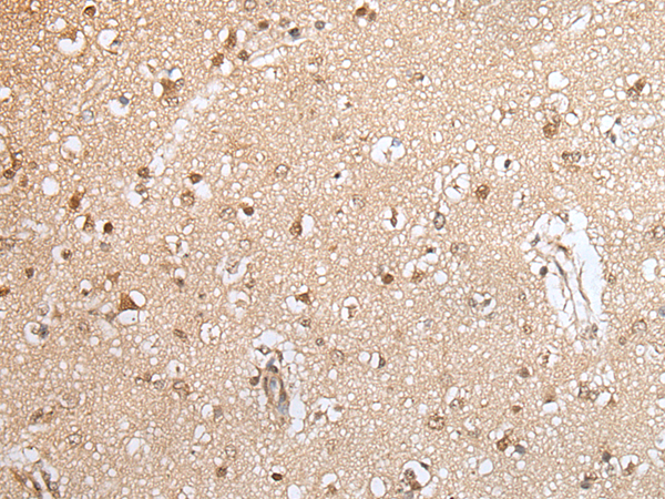 Anti-HOXA9 Rabbit Polyclonal Antibody