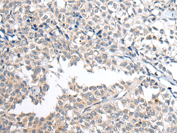 Anti-IFITM1 Rabbit Polyclonal Antibody