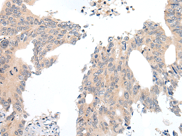 Anti-Nicotinic Acetylcholine Receptor alpha 5 Rabbit Polyclonal Antibody