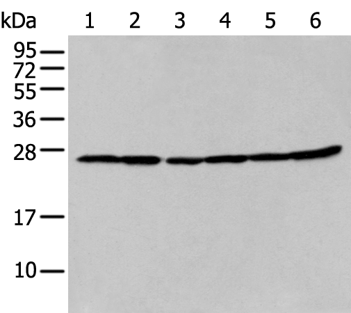 Anti-ERAB Rabbit Polyclonal Antibody