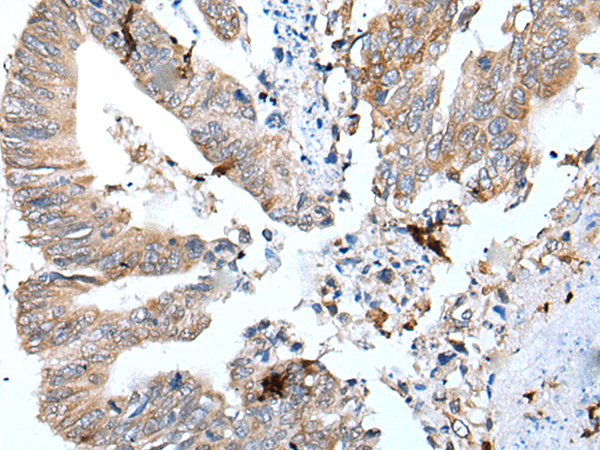 Anti-GKN1 Rabbit Polyclonal Antibody