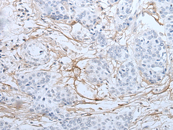 Anti-Interferon gamma Receptor 1 Rabbit Polyclonal Antibody