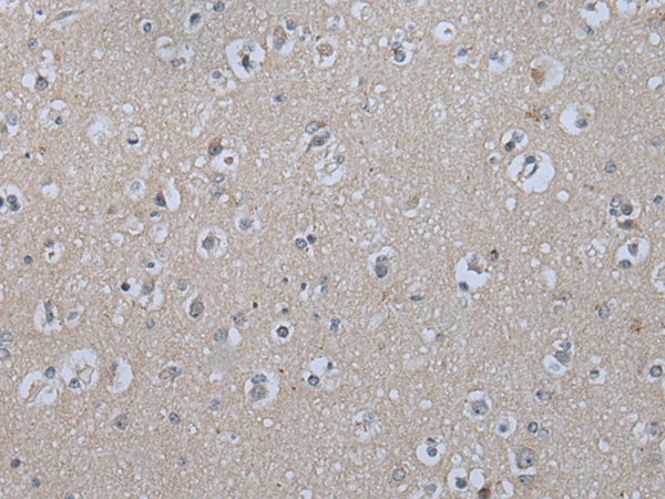 Anti-IL-9 Receptor Rabbit Polyclonal Antibody